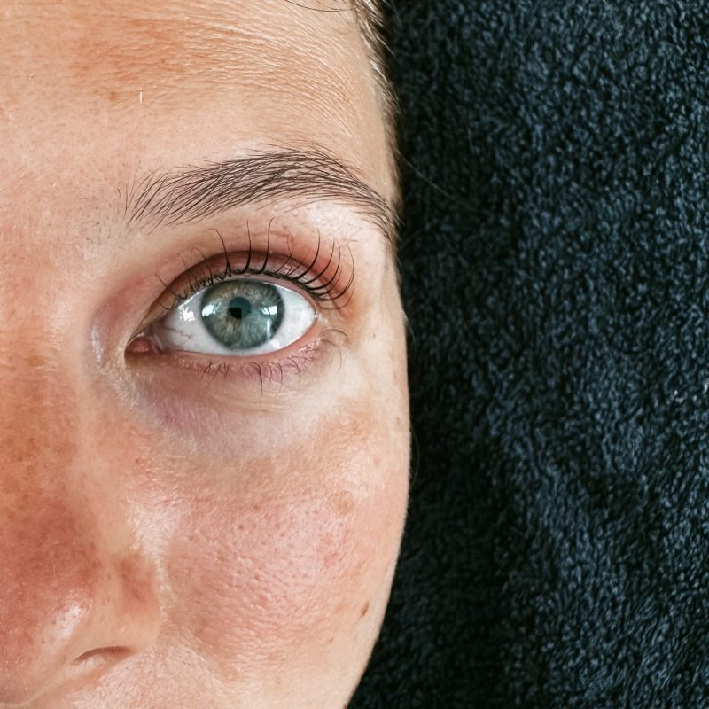 Nachher Bild Wimpernlifting